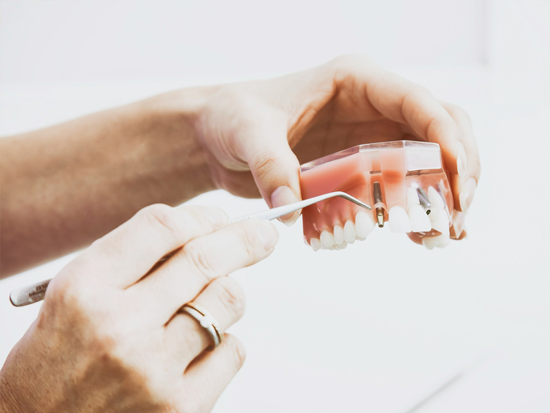 restorative-dentistry-img
